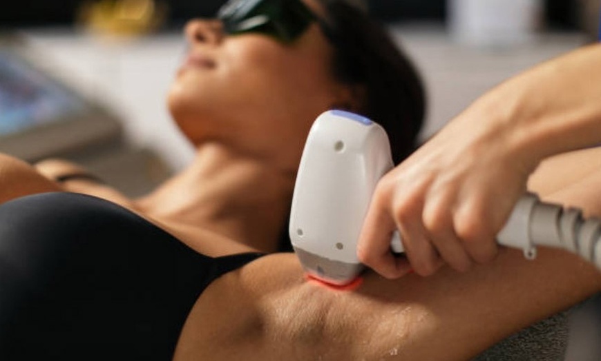 Image 5: 1, 3 o 5 sesiones de depilación láser en zona a elegir