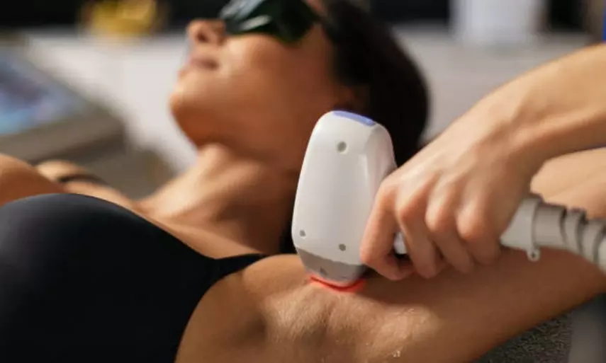 1, 3 o 5 sesiones de depilación láser en zona a elegir