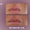 Image 6: Up to 71% Off on Injection - Dermal Filler at Divine Aesthetics Clinic London
