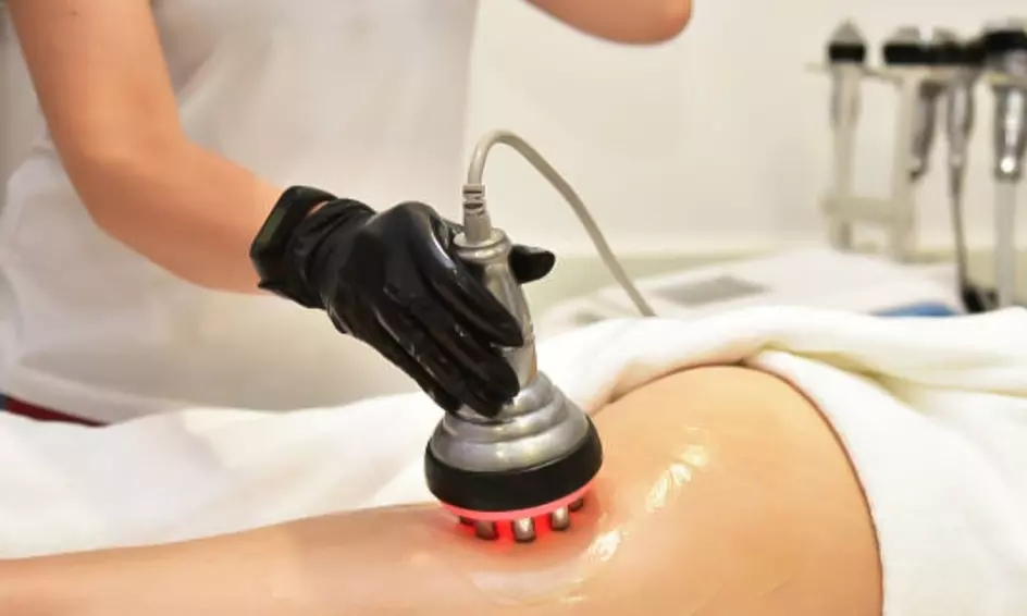 Revitalize w/ 5, 8, or 10 Ultrasound Cavitation Fat reduction Sessions