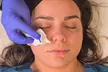 Revitalize Your Skin: One or Three Light or Deep Chemical Peels at Health Link Medical Group ( Up to 65% Off ) - Second Medium