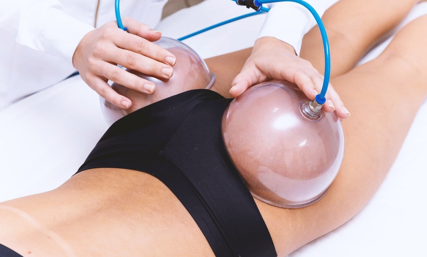 Image 1: 1, 2 or 3 Session of Brazilian Butt Lift &Cupping w/w/o Anti-Cellulite