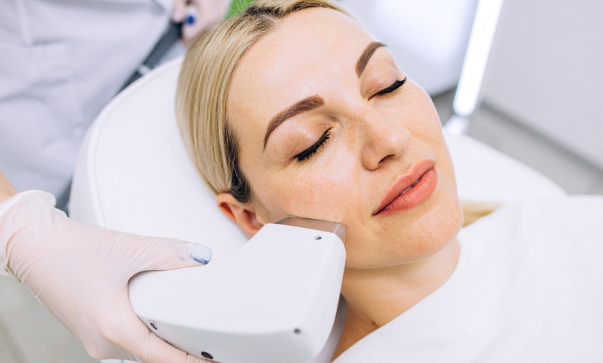 Image 1: Transform Your Skin w/ One, Three, or Six 60-Min IPL Facial Sessions