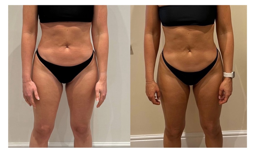 Image 3: Glow On the Go: One or Two Custom Spray Tan Sessions
