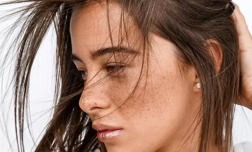 Image 2: Wrinkle Reduction on 2 or 3 Areas (Up to 3 Major & 1 or 2 Minor Areas)