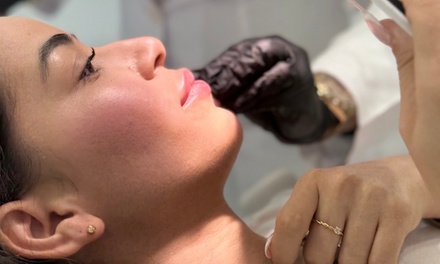 1 sesión de microlifting facial con Dermapen con exosomas en rostro completo - Lux Clinics