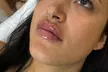 0.5ml or 1.1ml EPTQ Lip Filler for Natural-Looking Volume & Definition at Eliora Aesthetics(Up To 55% Off) - Image 2