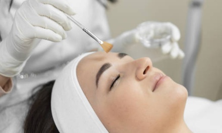 One Session of Advanced Chemical Peel Facial - Pro Aesthetics & Beauty