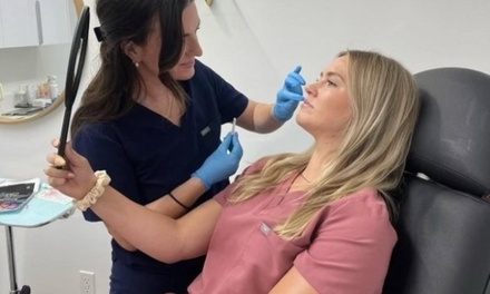 One Syringe of Juvéderm Voluma - Synerchi Medical Spa