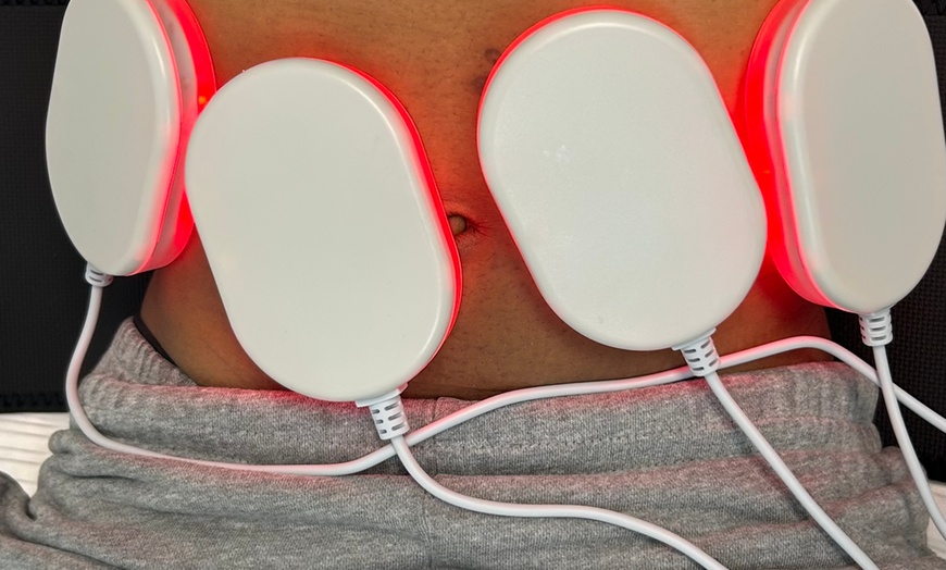 Image 3: Up to 94% off on Laser Lipo and Ultrasonic Cavitation Treatments