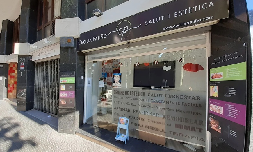 Image 12: Limpieza facial con opción a radiofrecuencia y tratamientos extra