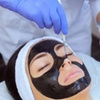 Image 11: Hollywood peeling con mascarilla de carbón activo y láser