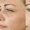 Image 1: Revitalize Your Look with 20 Units of Botox