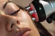 Youthful Radiance with One HIFU Session for Body, or Full Face & Neck at VB Treatments (Up to 68% Off) - Second Medium