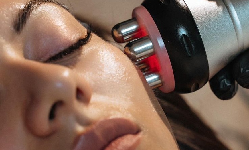 Image 3: Youthful Radiance with One HIFU Session for Body, or Full Face & Neck