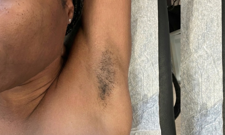 Image 4: Get Silky Smooth Skin with One, Three, or Five Bikini Waxing Packages