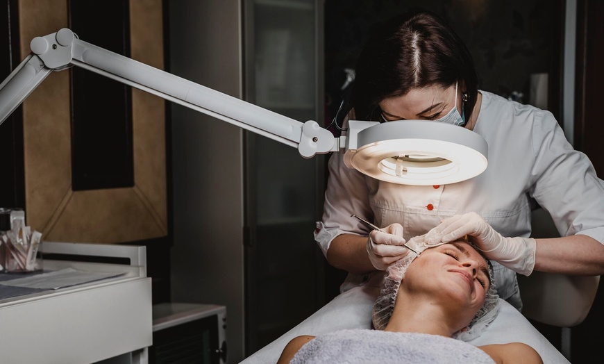 Image 4: Limpieza facial básica o profunda con opción a diferentes tratamientos