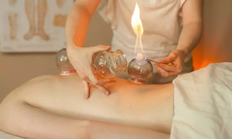 Relax with One, Three or Five Wet Cupping Sessions ( 1 Hour Each)