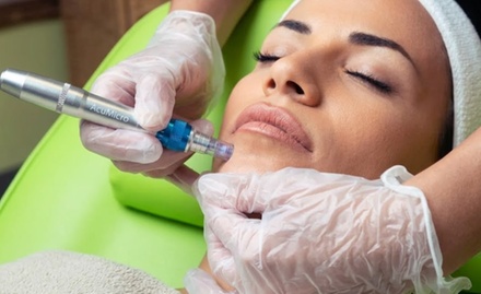 Basic AcuMicro Microneedling Pen with Hyaluronic Acid - Skin Serenity
