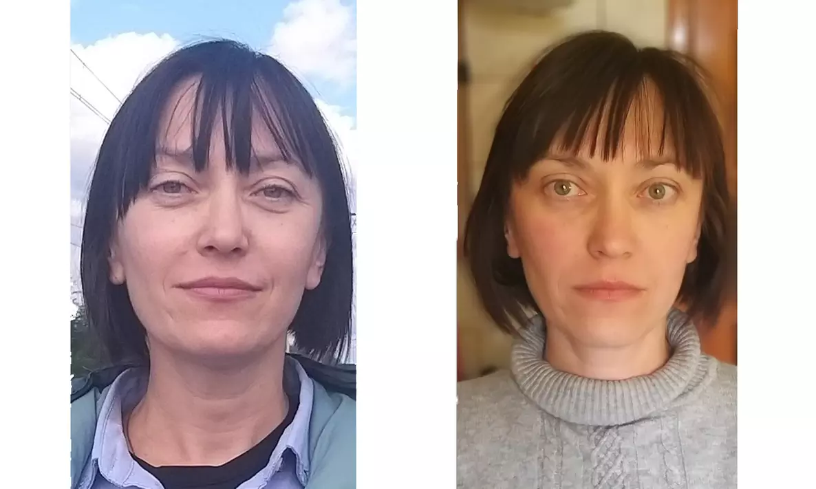 Liftingujący masaż twarzy, szyi i dekoltu Reface Laitlift z pielęgnacją – wybierz 1 lub 4 zabiegi (do -40%) - Image 6