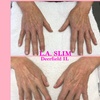 Image 2: Thermalift skin-tightening treatments for a contoured look