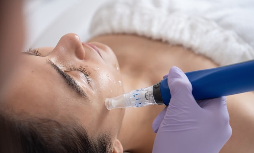 Image 2: Microneedling for Face & Neck or BB Glow Facial with Microneedling