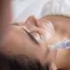 Image 2: Microneedling for Face & Neck or BB Glow Facial with Microneedling