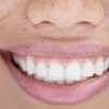 Image 3: Brighten Your Smile and Boost Your Confidence With Teeth Whitening