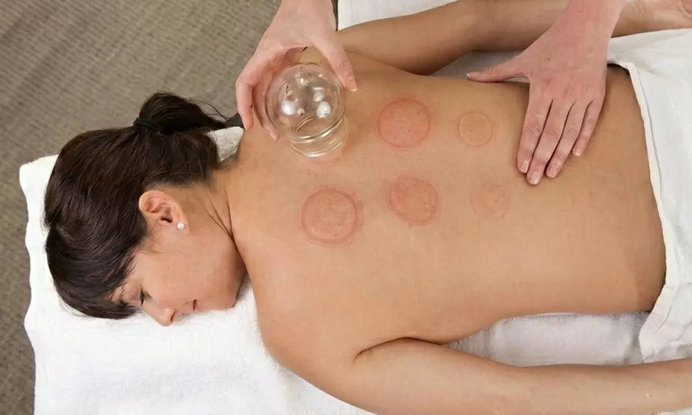 One or Three Cupping Sessions: Relieve Tension and Improve Blood Flow At Kelly Foster Wellness - Primary Image
