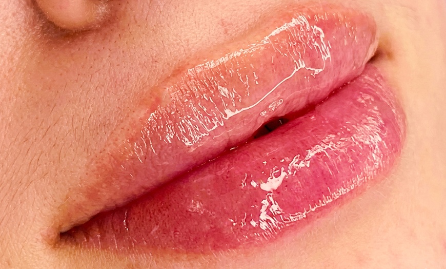 Image 7: Limpieza facial con tratamiento antiarrugas, hydralips, relleno y más