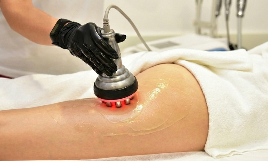 Image 2: 1, 3, or 6 Sessions of Radio Frequency Skin Tightening Treatments 