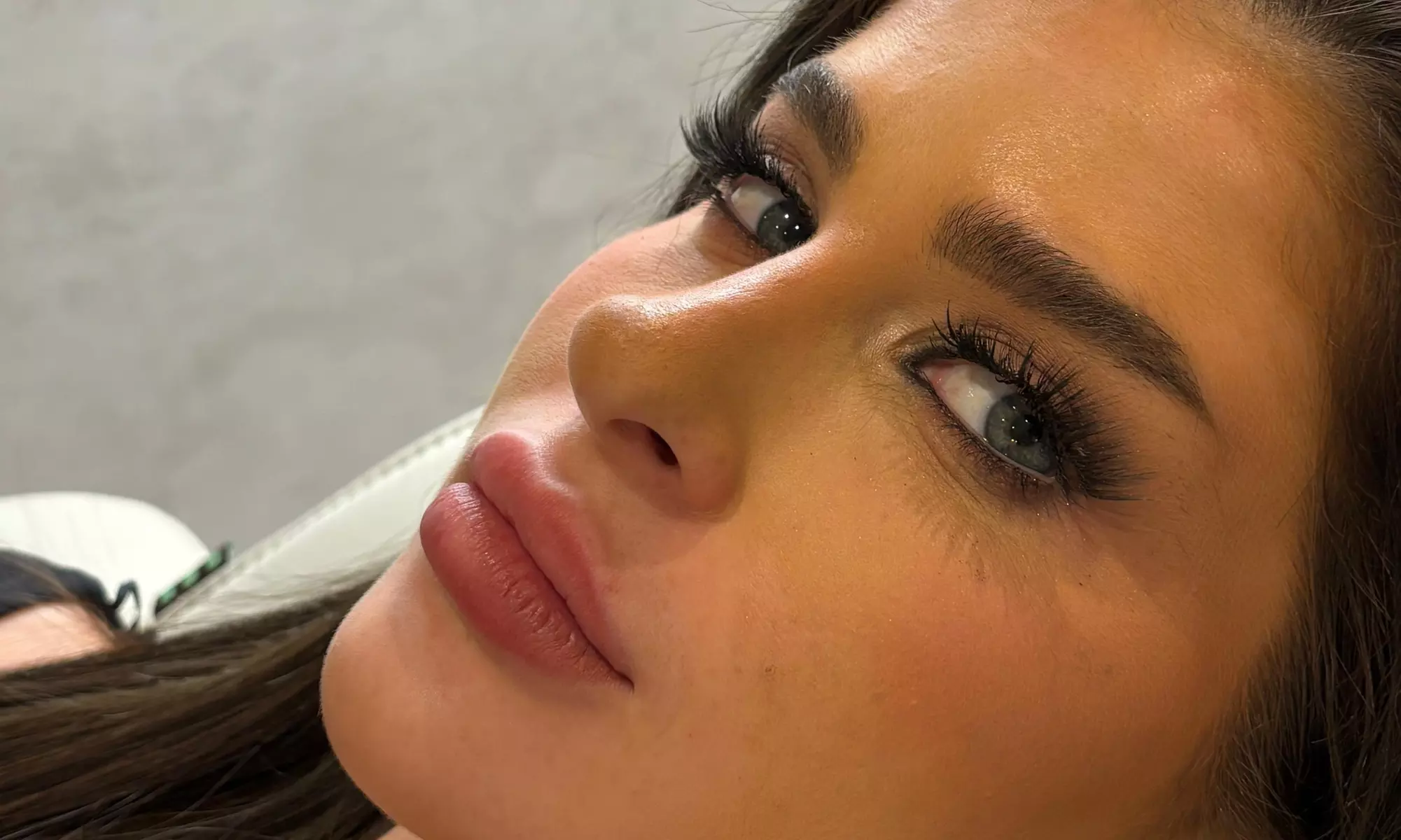 Refresh Your Look: 0.5ml, 1ml & 2ml Dermal Fillers with Consultation