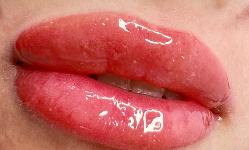 Image 10: Limpieza facial con tratamiento antiarrugas, hydralips, relleno y más