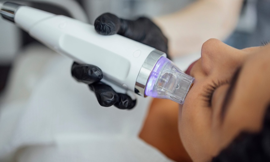 Image 1: 1, 2, or 3 Full Face & Neck Profound RF Microneedling + Rejuran Healer