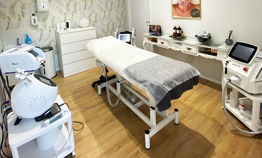 Image 3: 1 o 2 sesiones de exosomas con dermapen en rostro completo y limpieza 