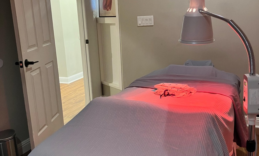 Image 2: Acupuncture & Cupping Therapy