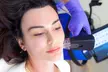 Revitalize with Micro needling with Peptide & Stem Cells, PRP Treatment, Salmon DNA & More  Up to  72% Off - Second Medium