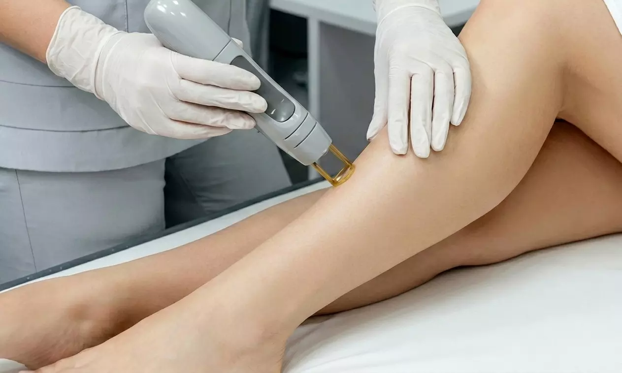 3 or 6 Laser Hair Removal on Small, Medium, Large or X-Large Area