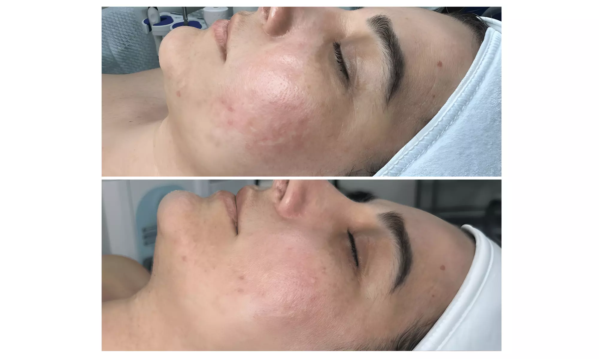 Up to 53% Off on Facial at Gisele Domingos Skincare Specialist