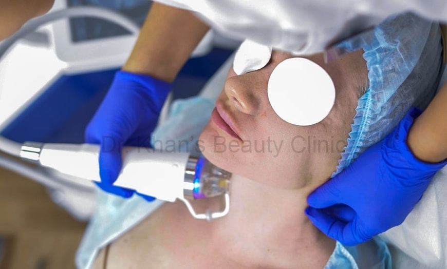 Image 1: 45-Minute RF Gold Microneedling Session at Dr Khan's Beauty Clinic