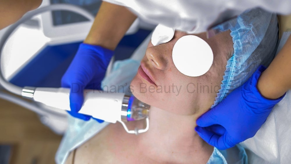 45-Minute RF Gold Microneedling followed by 13 Vitamins booster