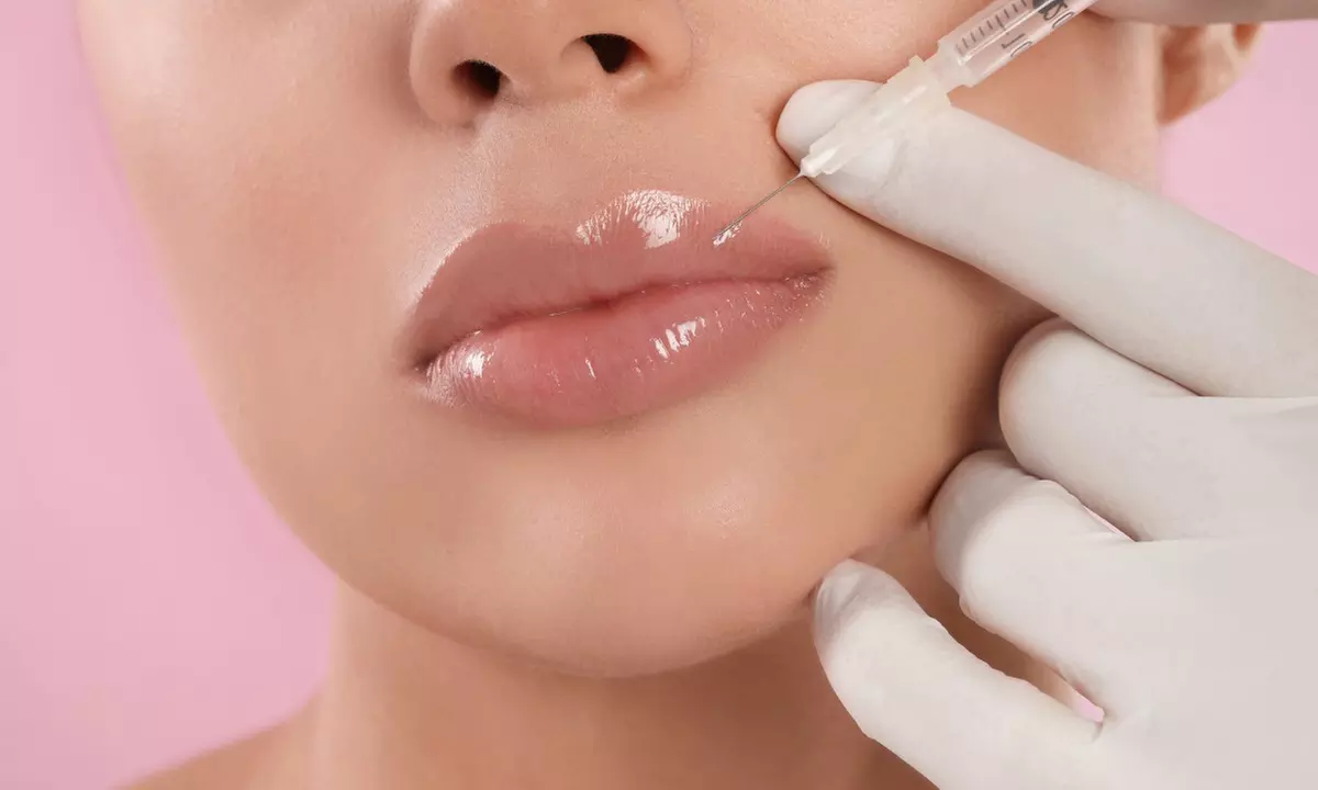 Enhance Your Natural Beauty with Restylane or Juvederm Dermal Fillers