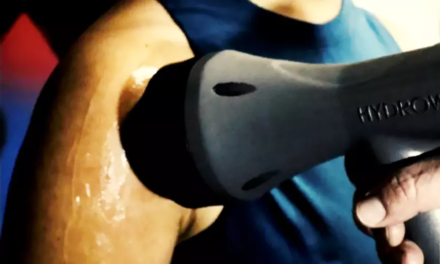 Rejuvenate with Spinewise: Shockwave Therapy Benefits and Initial Treatment Up To 61% Off - Primary Image