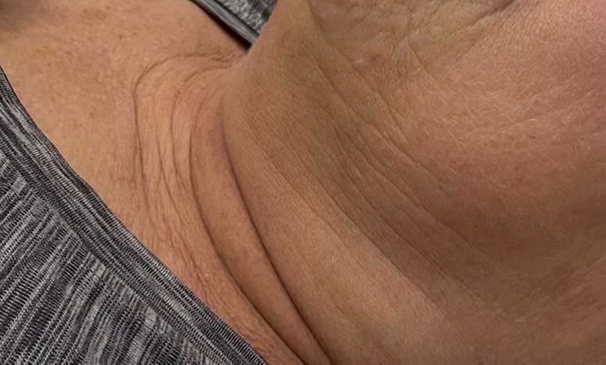 Image 5: Relax with Cryo & Thermal Body sculpting (2 or 3 sessions)