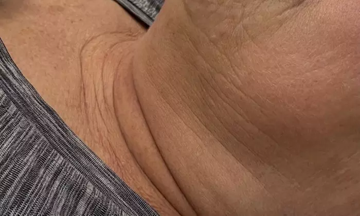 Relax with Cryo & Thermal Body sculpting (2 or 3 sessions)