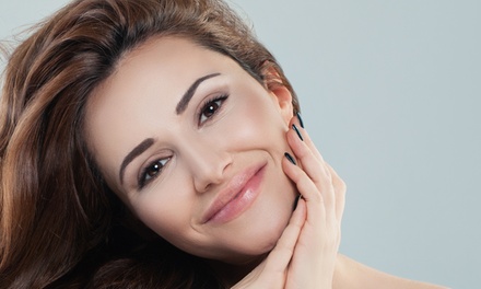 One Micro-Needling Treatment - Infinity Love Aesthetics