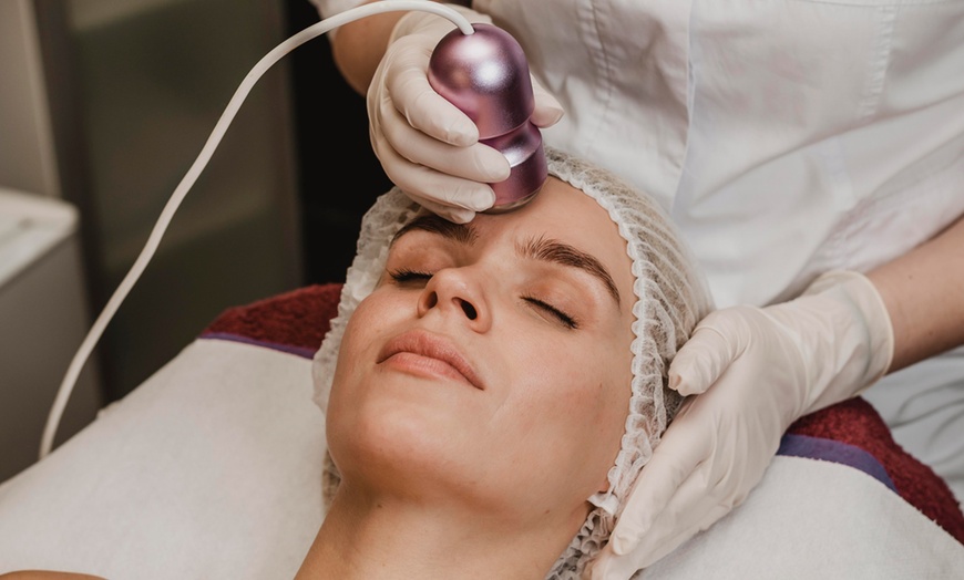 Image 3: 1, 2, 3 o 4 sesiones de radiofrecuencia facial de cara y cuello 