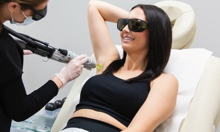 6 Laser Hair Removal Sessions on Full Face or Part of Face - Medspa California