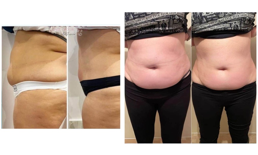 Image 4: Up to 83% Off EMS Body Sculpting - Tighten, Tone & Define 