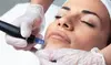 Get a Hydrafacial w/ Optional Hyaluronic Acid, Microdermabrasion, Dermaplaning or Radio Frequency (Up to 23%Off)